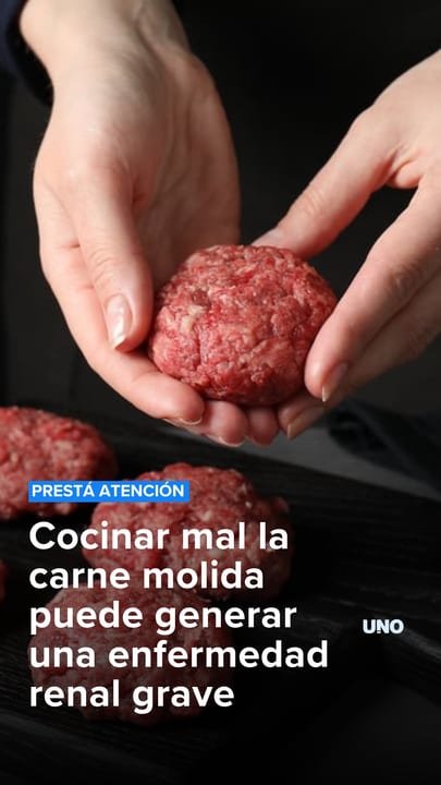 Cocinar mal la carne picada puede causar una enfermedad renal