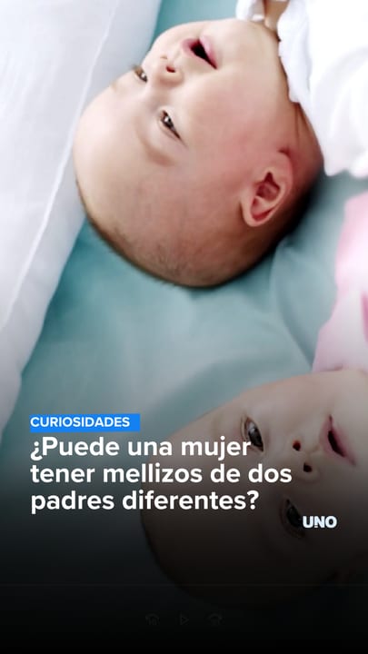 ¿Puede una mujer tener mellizos de dos padres diferentes?